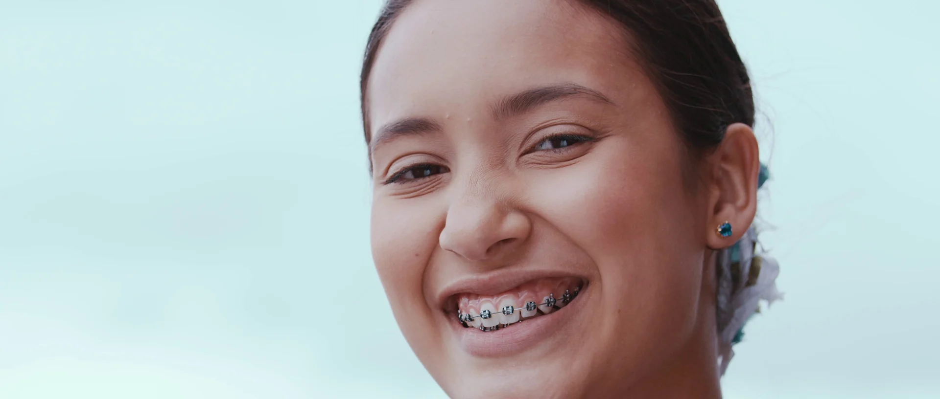 Retrato de uma jovem de aparelho nos dentes sorrindo para a câmera, com o céu claro ao fundo.